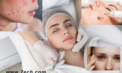 Cosmetic Dermatology: Enhancing Your Skin’s Beauty
